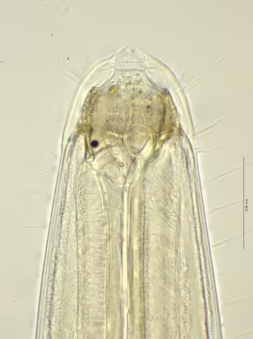 head region 100x stack