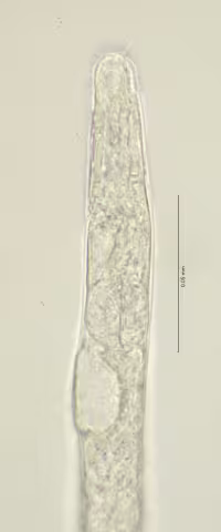 head region 100x stack