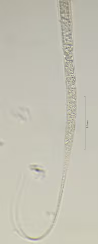 tail region 40x obligue