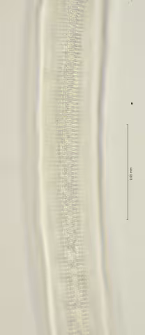 lateral field at mid body 100x