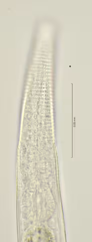 lateral field at oesophagus 100x