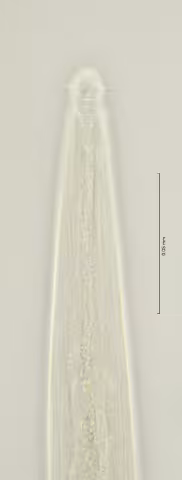 head region w amphid and cephalic setae 100x