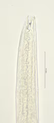 head region 100x stack