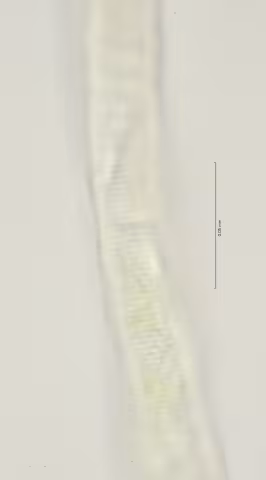 lat diff vulva region 100x