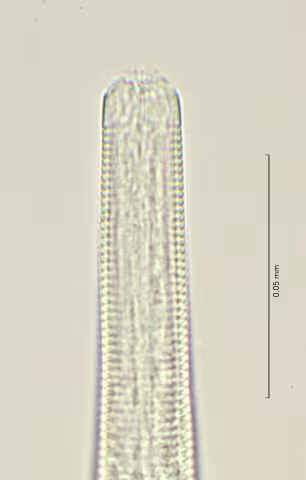 head region w cephalic seta 100