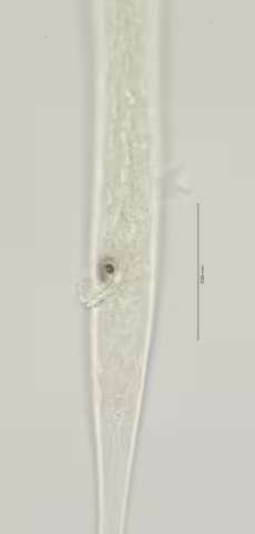 cloaca region w gubernaculum and left spicule 100x