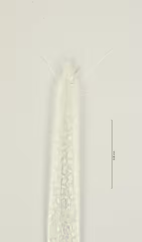head region w cephalic and subcephalic setae 100x