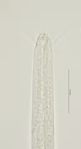 head region w dorsal tooth 100x