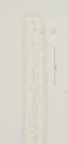 ead region w amphid and lateral field 100x