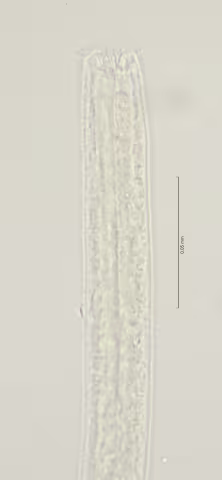 head region w right subventral teeth 100x