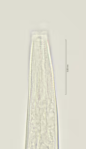 head region w cephalic setae and amphid 100x