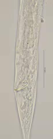 cloaca region w spiculum 100x