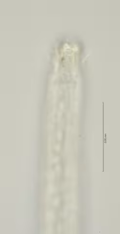 head region w amphid 100x