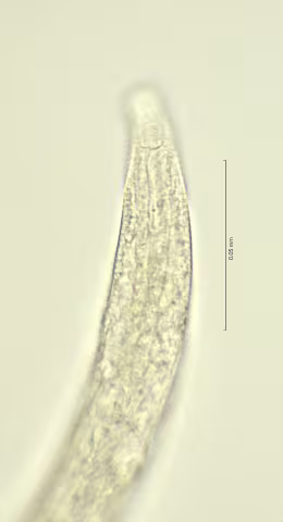 head region w amphid and cephalic setae 100x