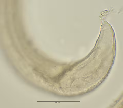 tail region w spineret 100x