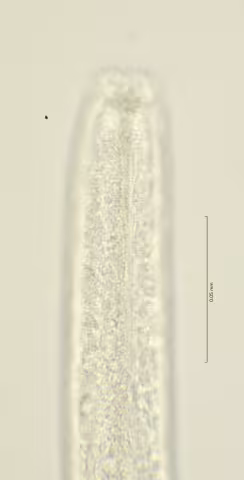 head region w amphid 100x