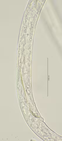 tail region 100x stack