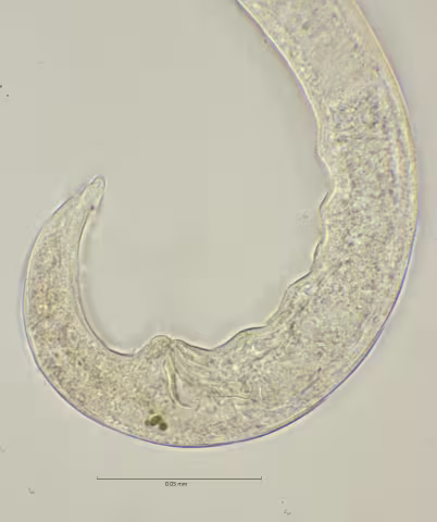 tail region, 100x, stack