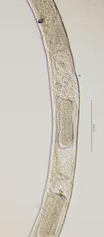 vulva region 40x obligue