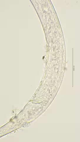 cloaca region 100x stack