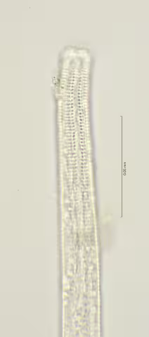 head region w amphid 100x