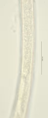 lateral field mid body 100x