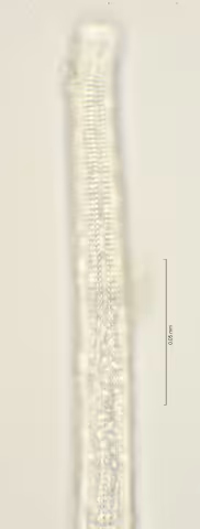 lateral field oesophagus region 100x