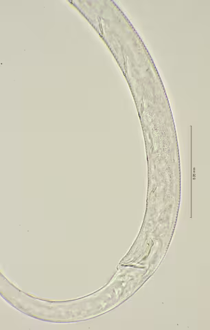 cloaca region 100x stack