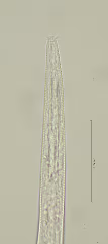 head region 100x stack