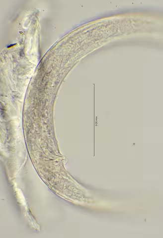 tail region 100x stack