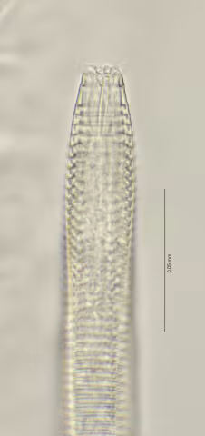 head region w dorsal tooth 100x
