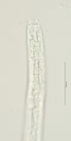 head region w amphid 100x