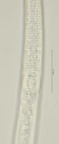 lateral field oesophagus end 100x