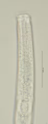 lateral field oesophagus region 100x