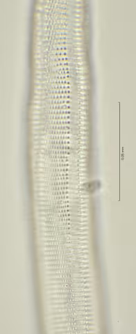 lateral field at oesophagus end 100x