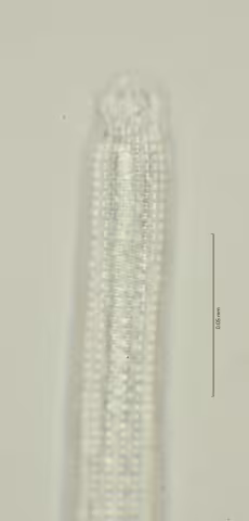 head region w amphid 100x