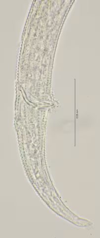 tail region 100x stack