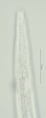 lat diff oesophagus region 100x