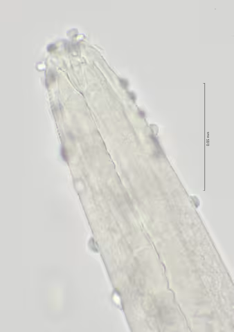 head region w dorsal tooth 100x