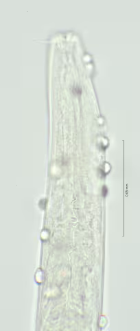 head region w amphid 100x