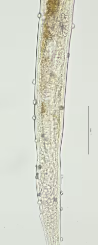 posterior part demannian system 40x