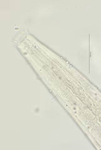 head region w amphid 100x