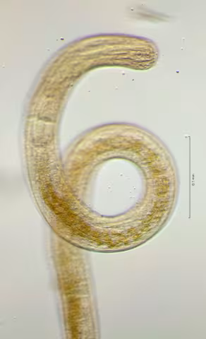 head region w amphid 40x obligue