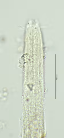 head region w amphid 100x