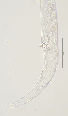 cloaca region 100x stack