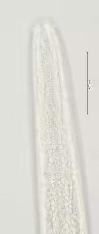 head region w amphid 100x