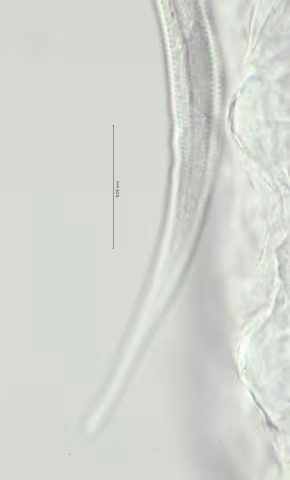 lateral field at anal region 100x