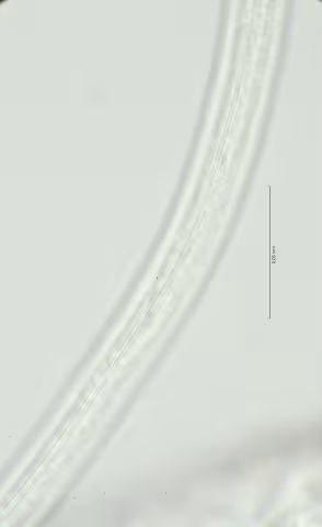 lateral field at mid body 100x