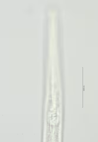lateral field at oesophagus end 100x