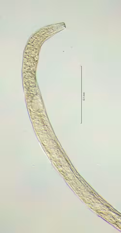 head region 40x obligue stack, showing position of both amphids